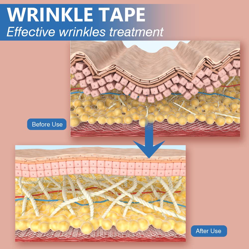 wrinkle tape .. wrinkle tape ..